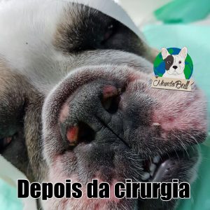 depois